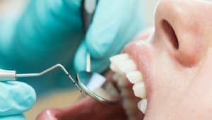 mulher no dentista profilaxia